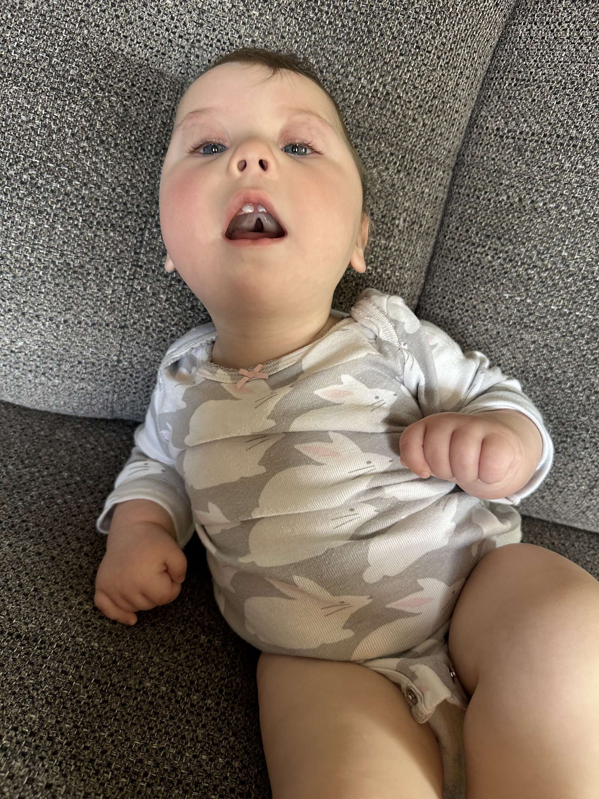 Soft Palate Cleft.jpg