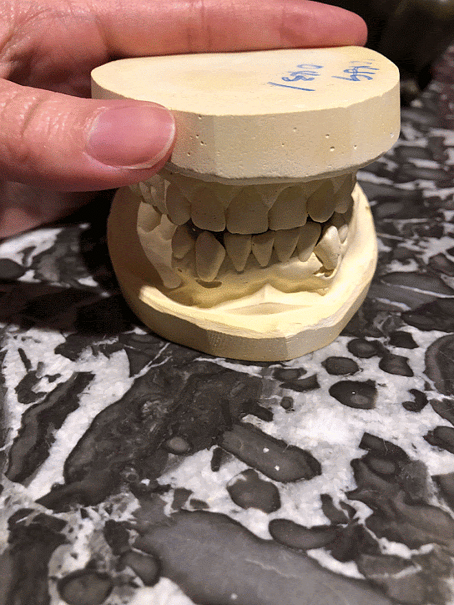 07 story of my teeth.gif